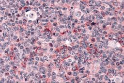 Immunohistochemistry of Caspase-3 in human tonsil tissue with Caspase-3 antibody at 5 μg/mL.