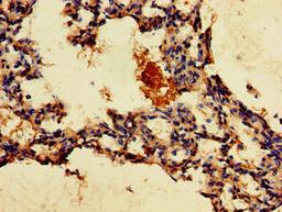 Immunohistochemistry of paraffin-embedded human lung tissue using CSB-PA009813LA01HU at dilution of 1:100