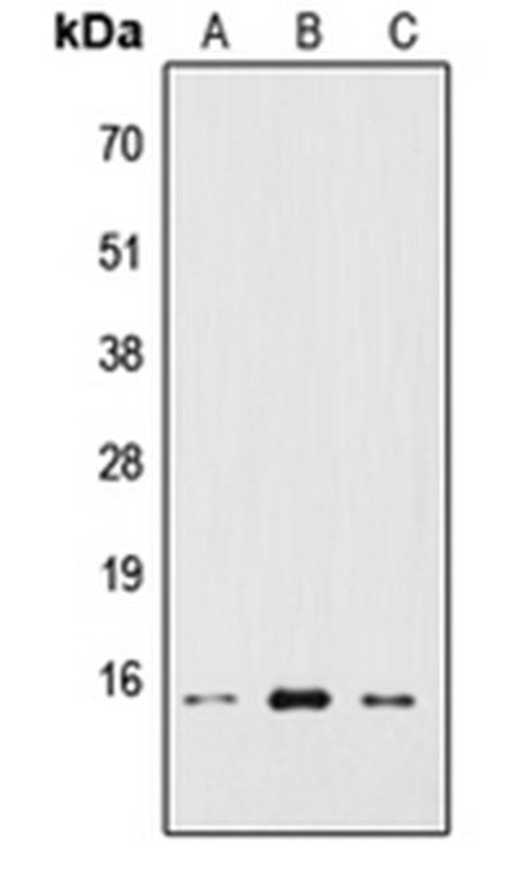 Western blot analysis of HEK293T (Lane 1), Raw264.7 (Lane 2), H9C2 (Lane 3) whole cell lysates using RPS19BP1 antibody