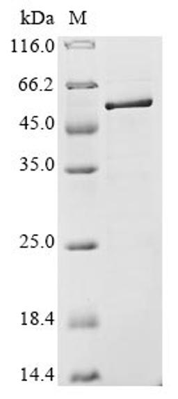 (Tris-Glycine gel) Discontinuous SDS-PAGE (reduced) with 5% enrichment gel and 15% separation gel.