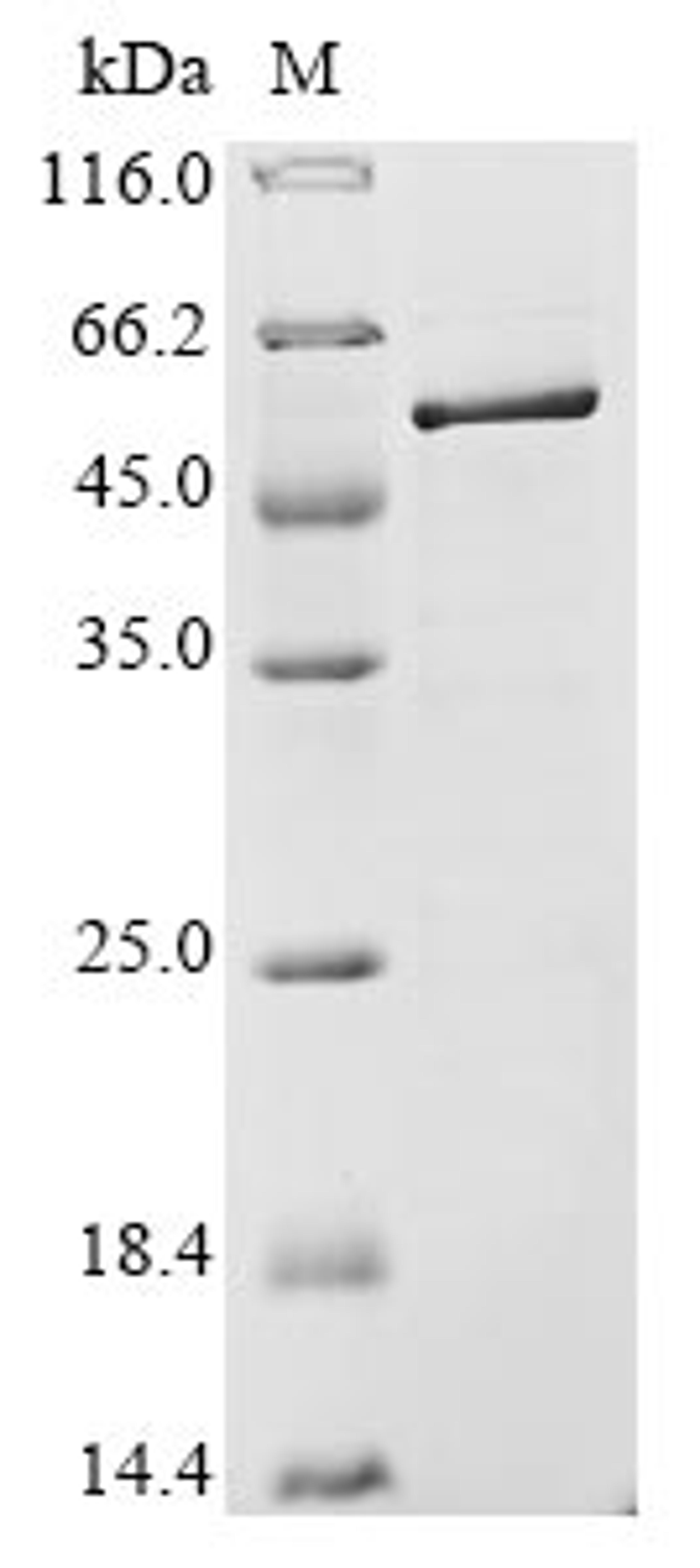 (Tris-Glycine gel) Discontinuous SDS-PAGE (reduced) with 5% enrichment gel and 15% separation gel.