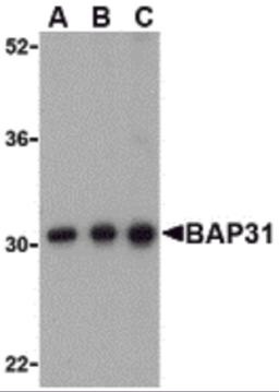 Western blot analysis of BAP31 in Ramos cell lysate with BAP31 antibody at (A) 0.5, (B) 1 and (C) 2&#956;g/mL.