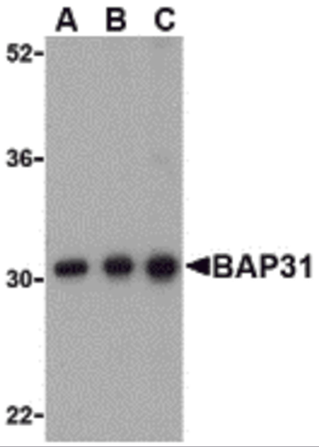 Western blot analysis of BAP31 in Ramos cell lysate with BAP31 antibody at (A) 0.5, (B) 1 and (C) 2μg/mL.