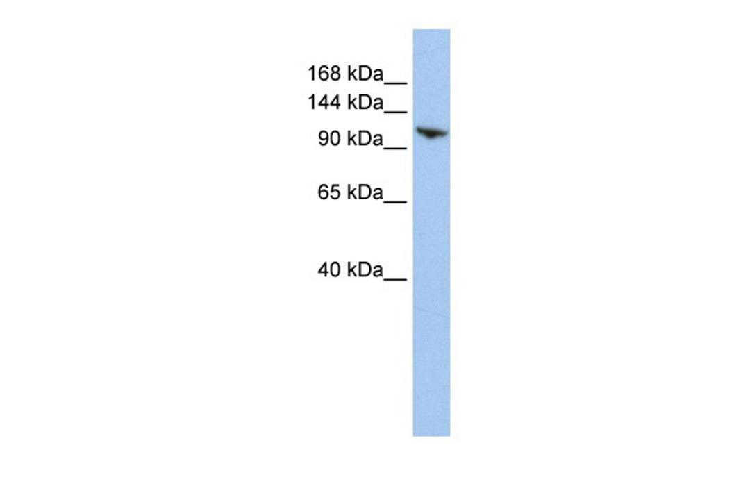 Antibody used in WB on Human HepG2 at 0.2-1 ug/ml.