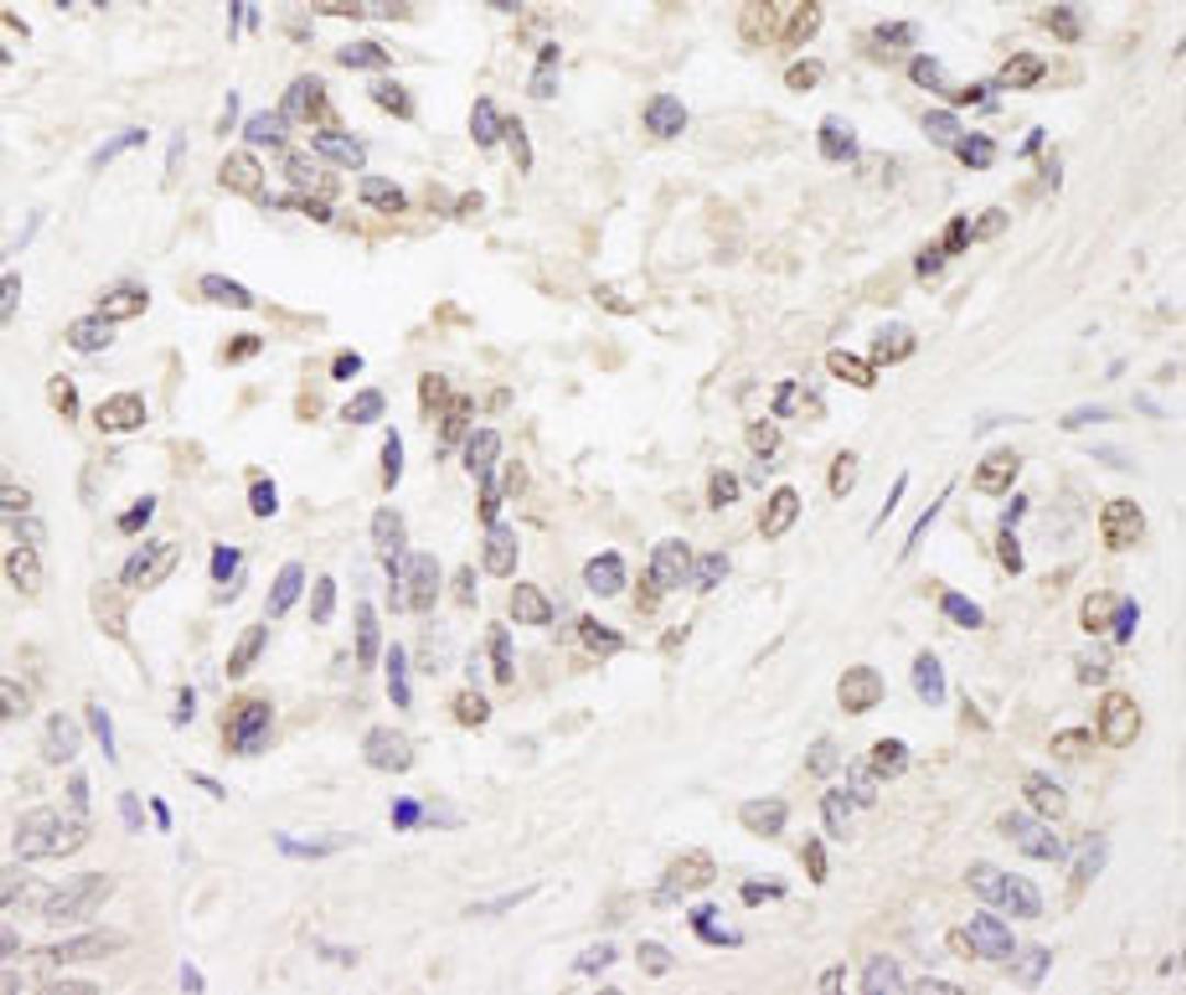 Detection of human FOG1/ZFPM1 by immunohistochemistry.