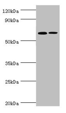 Western blot. All lanes: IL27RA antibody at 9ug/ml. Lane 1: Rat heart tissue. Lane 2: Rat brain tissue. Secondary. Goat polyclonal to rabbit IgG at 1/10000 dilution. Predicted band size: 69 kDa. Observed band size: 69 kDa. 