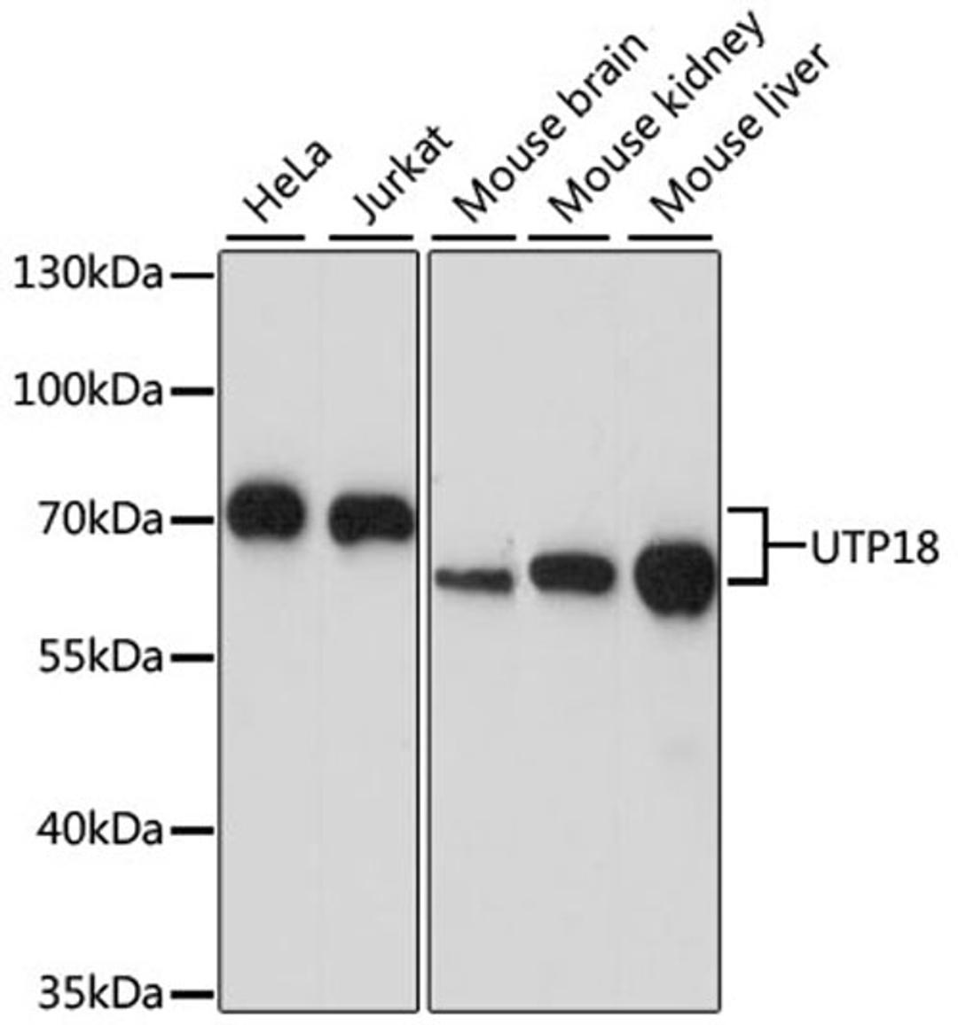 Western blot - UTP18 antibody (A15441)