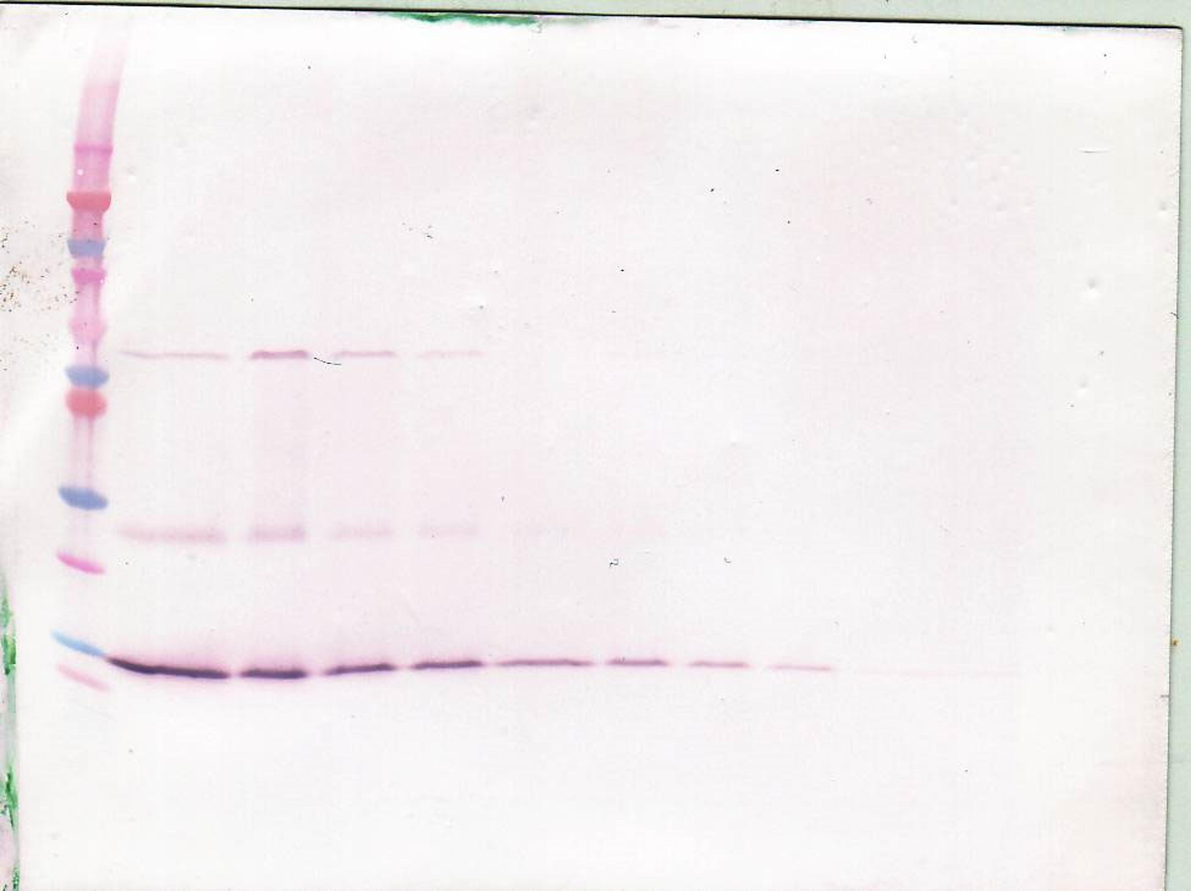 To detect hBDNF by Western Blot analysis this antibody can be used at a concentration of 0.1 - 0.2 ug/ml. Used in conjunction with compatible secondary reagents the detection limit for recombinant hBDNF is 1.5 - 3.0 ng/lane, under either reducing or non-r