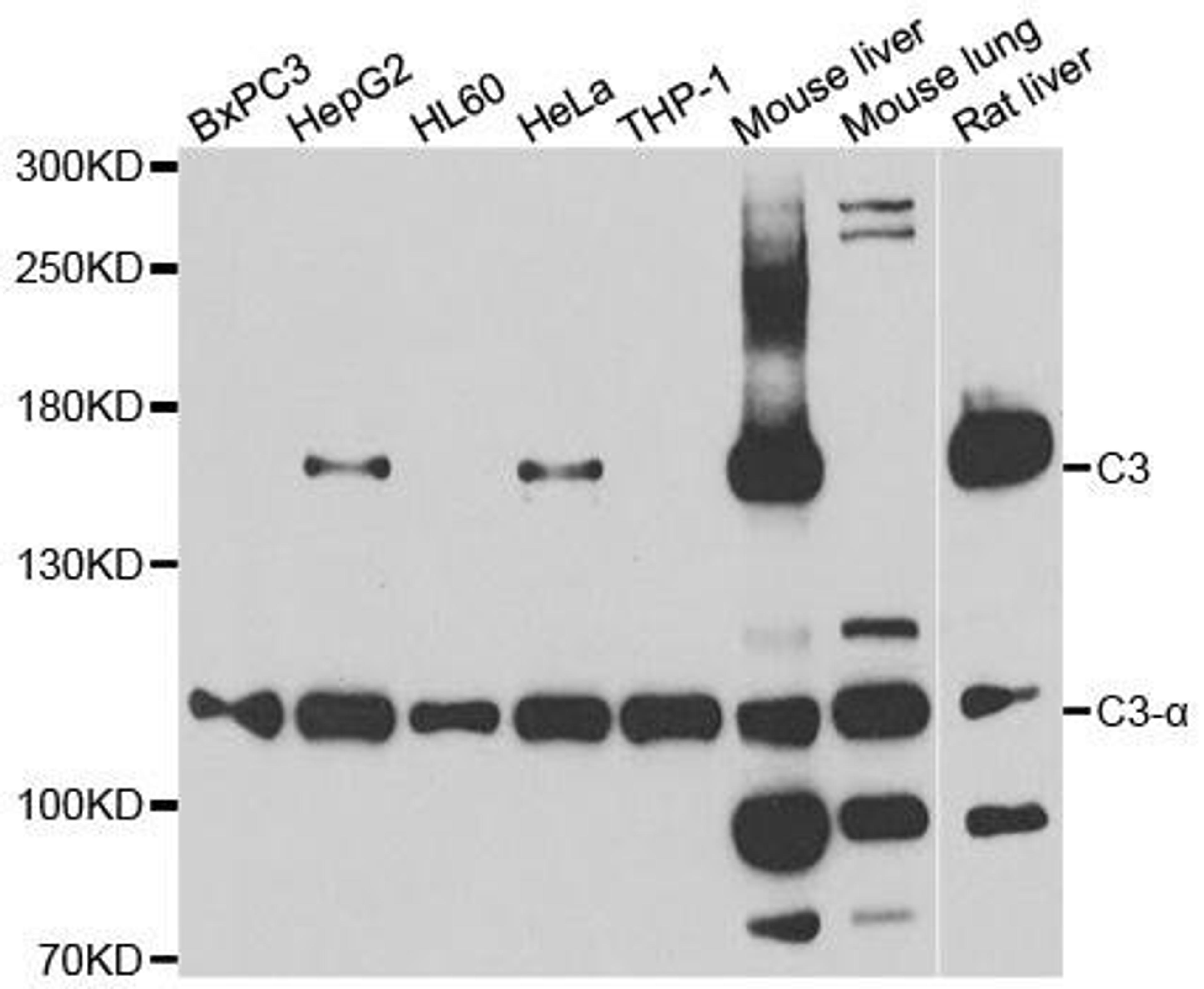 Western blot analysis of extracts of various cell lines using Complement C3 antibody