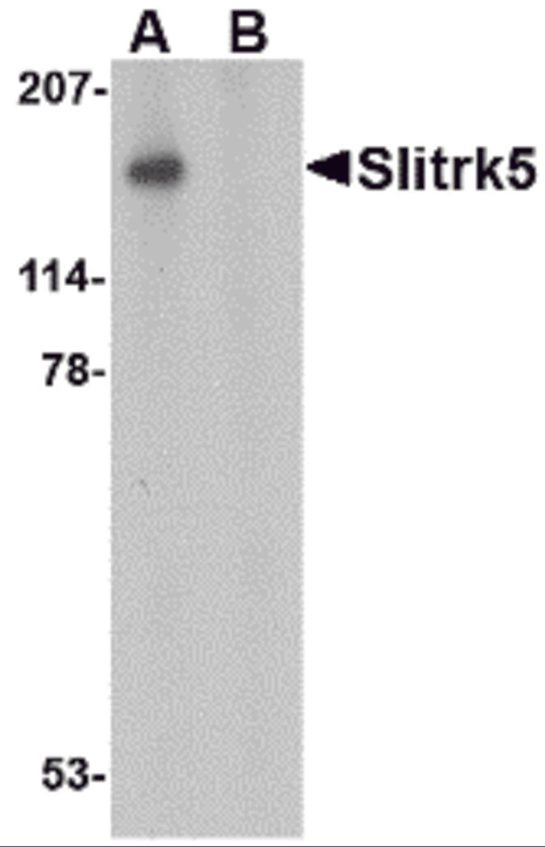 Western blot analysis of Slitrk5 in 3T3 cell lysate with Slitrk5 antibody at 1 μg/mL in the (A) absence or (B) presence of blocking peptide.