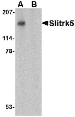 Western blot analysis of Slitrk5 in 3T3 cell lysate with Slitrk5 antibody at 1 μg/mL in the (A) absence or (B) presence of blocking peptide.