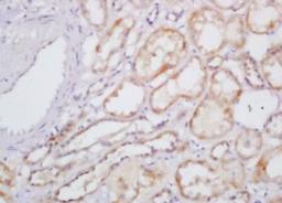 Immunohistochemical analysis of formalin-fixed paraffin embedded human kidney tissue using IL-31 antibody (dilution at 1:200)