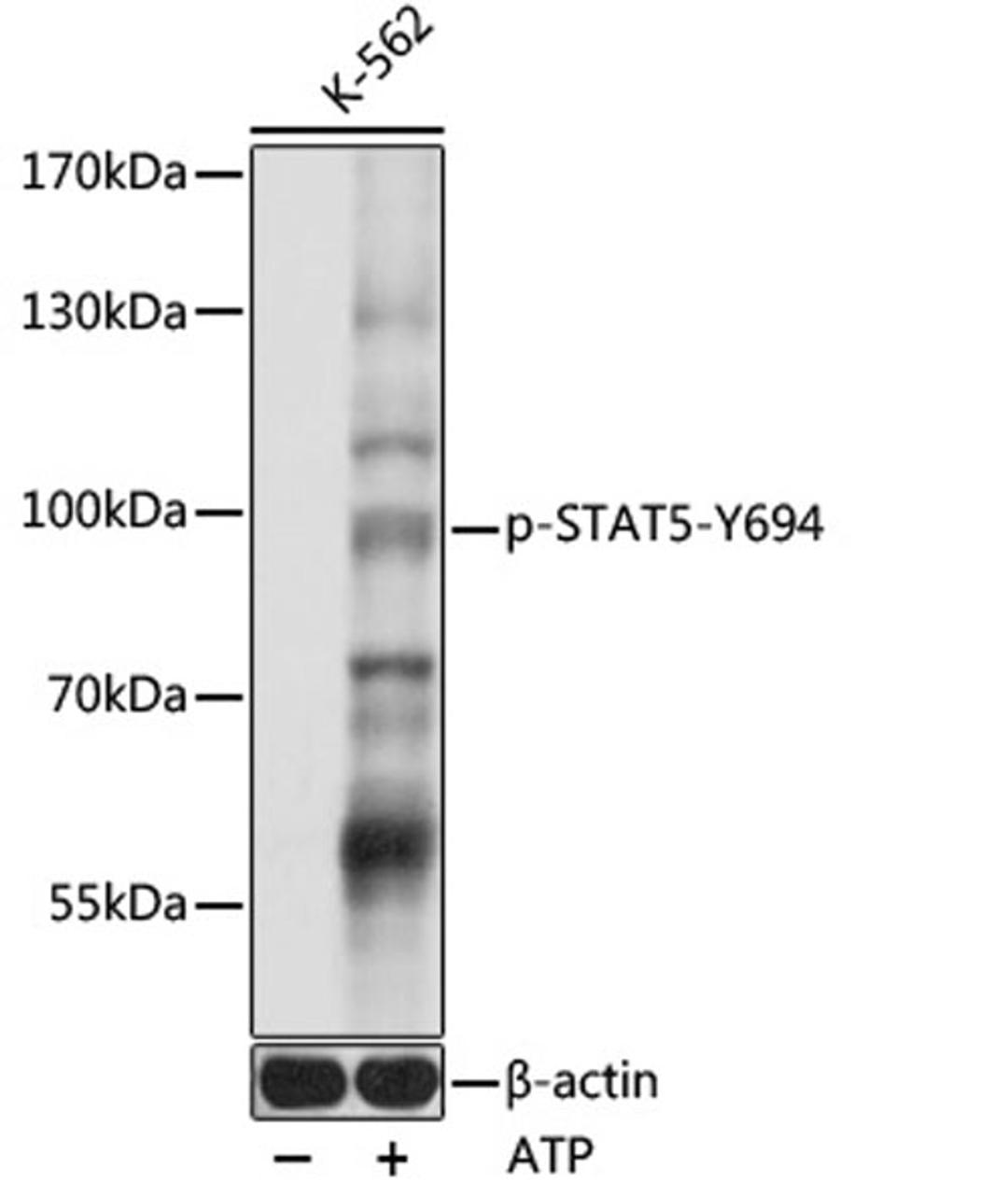 Western blot - Phospho-STAT5-Y694 pAb (AP0887)