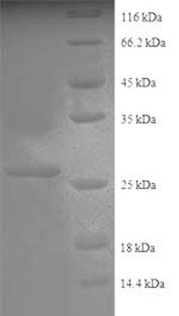 (Tris-Glycine gel) Discontinuous SDS-PAGE (reduced) with 5% enrichment gel and 15% separation gel.