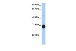 Antibody used in WB on Human Muscle at 0.2-1 ug/ml.