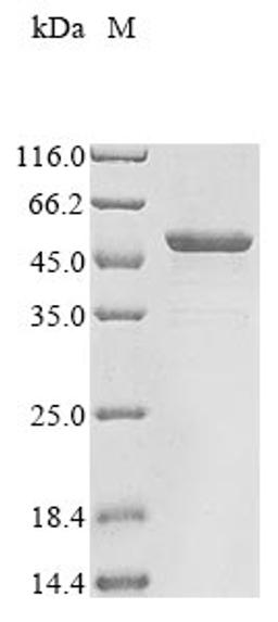 (Tris-Glycine gel) Discontinuous SDS-PAGE (reduced) with 5% enrichment gel and 15% separation gel.