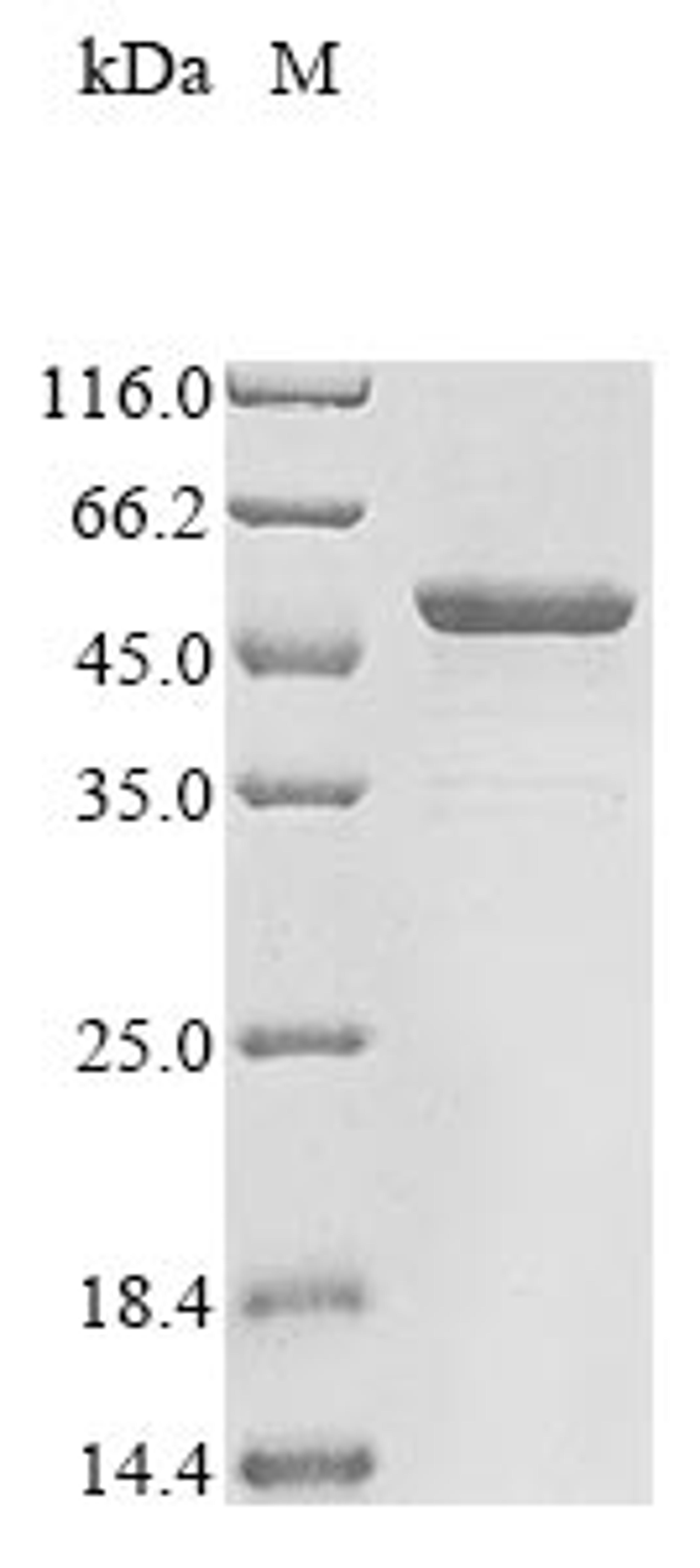 (Tris-Glycine gel) Discontinuous SDS-PAGE (reduced) with 5% enrichment gel and 15% separation gel.
