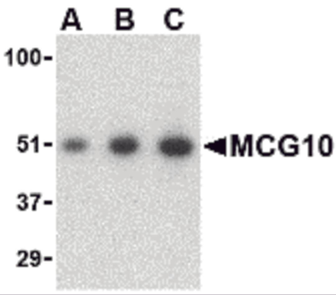 Western blot analysis of MCG10 in HeLa cell lysate with MCG10 antibody at (A) 0.5, (B) 1 and (C) 2 μg/mL.