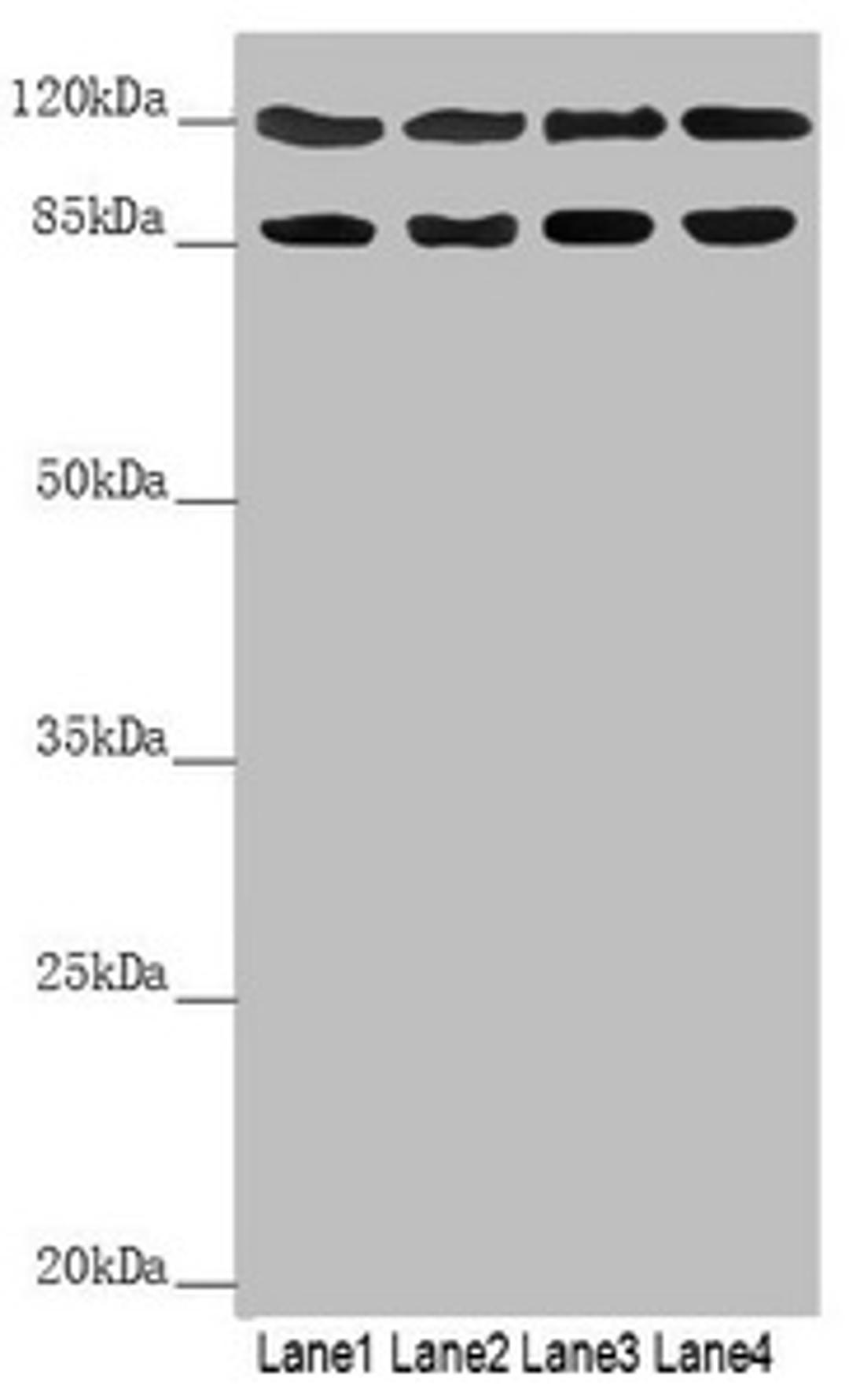 Western blot. All lanes: SCYL1 antibody at 3.15 ug/ml. Lane 1: 293T whole cell lysate. Lane 2: Hela whole cell lysate. Lane 3: 3T3 whole cell lysate. Lane 4: A549 whole cell lysate. Secondary. Goat polyclonal to rabbit IgG at 1/10000 dilution. Predicted band size: 90, 89, 79, 87, 70 kDa. Observed band size: 90, 110 kDa. 