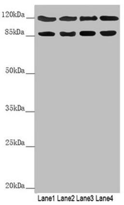 Western blot. All lanes: SCYL1 antibody at 3.15 ug/ml. Lane 1: 293T whole cell lysate. Lane 2: Hela whole cell lysate. Lane 3: 3T3 whole cell lysate. Lane 4: A549 whole cell lysate. Secondary. Goat polyclonal to rabbit IgG at 1/10000 dilution. Predicted band size: 90, 89, 79, 87, 70 kDa. Observed band size: 90, 110 kDa. 
