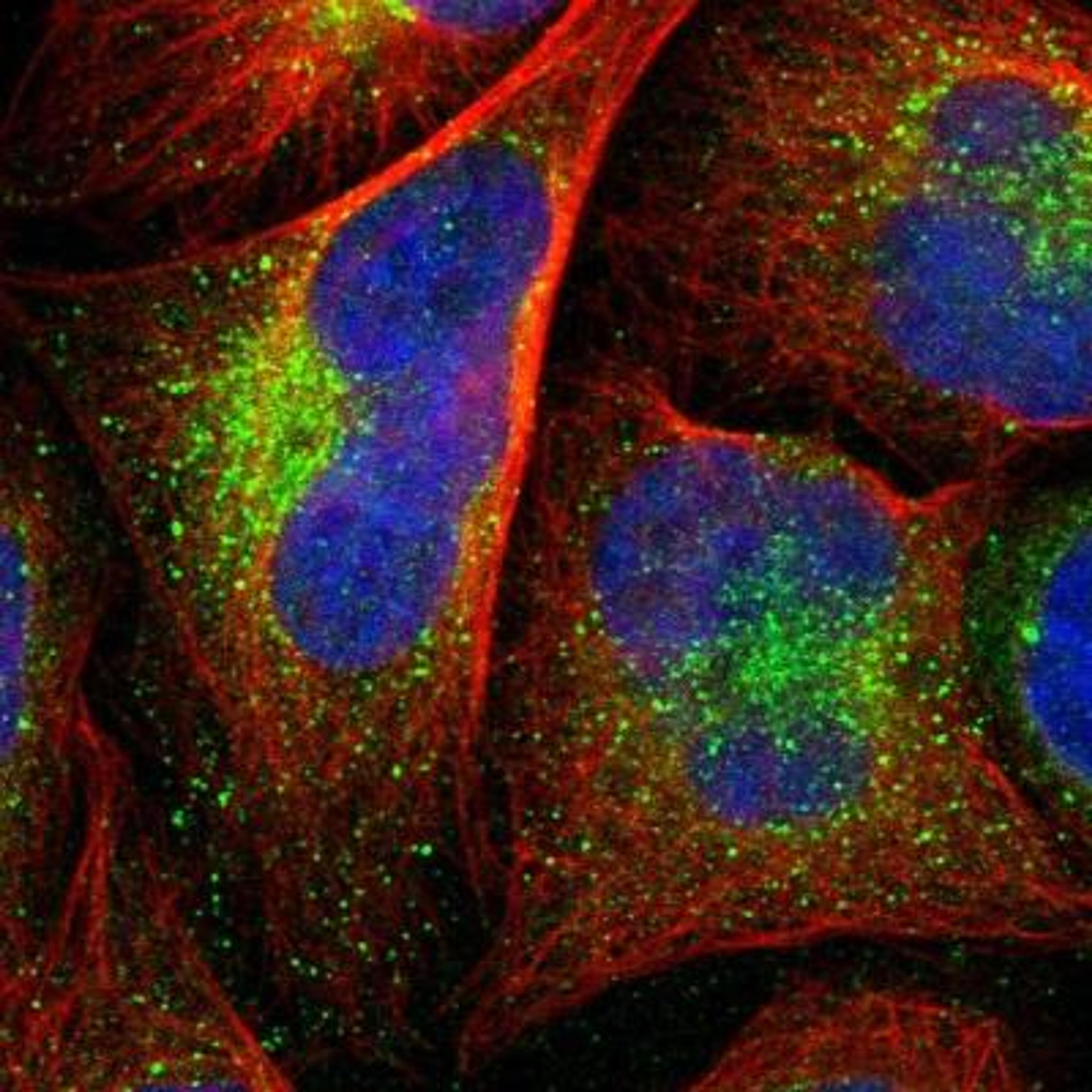 Immunocytochemistry/Immunofluorescence: EFCBP2 Antibody [NBP1-84002] - Analysis of human cell line U-2 OS shows positivity in vesicles. Antibody staining is shown in green.