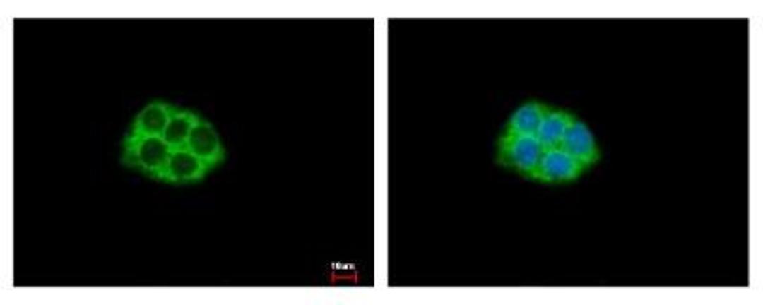 Immunocytochemistry: RPL5 Antibody [NBP1-31413] - Sample: HepG2 cells were fixed in 4% paraformaldehyde at RT for 15 min. Green: RPL5 protein stained by RPL5 antibody diluted at 1:500. Blue: Hoechst 33343 staining.