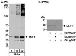 Detection of human MLF1 by western blot and immunoprecipitation.