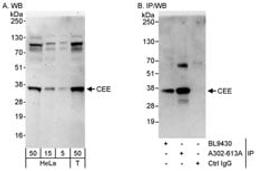 Detection of human CEE by western blot and immunoprecipitation.