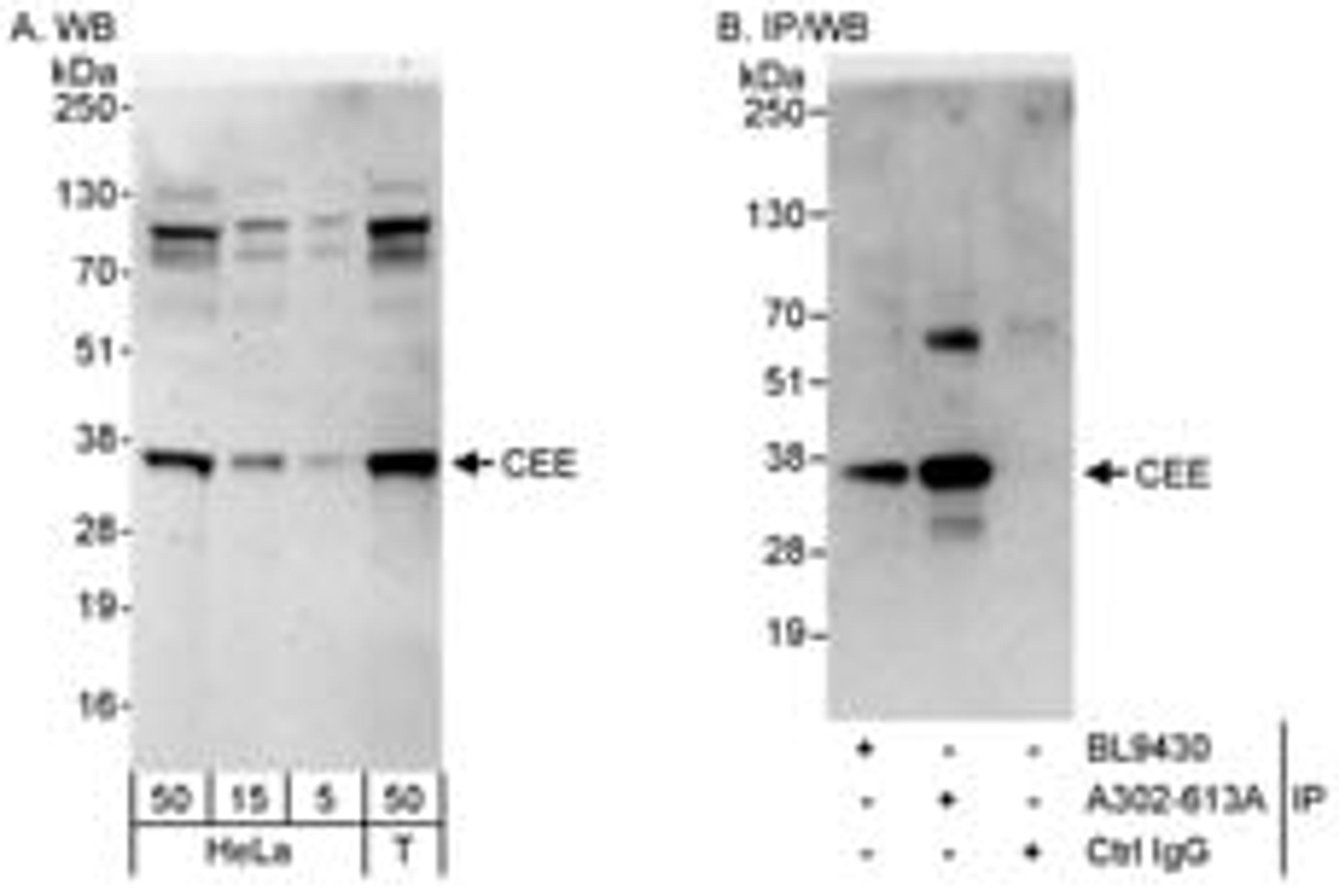 Detection of human CEE by western blot and immunoprecipitation.