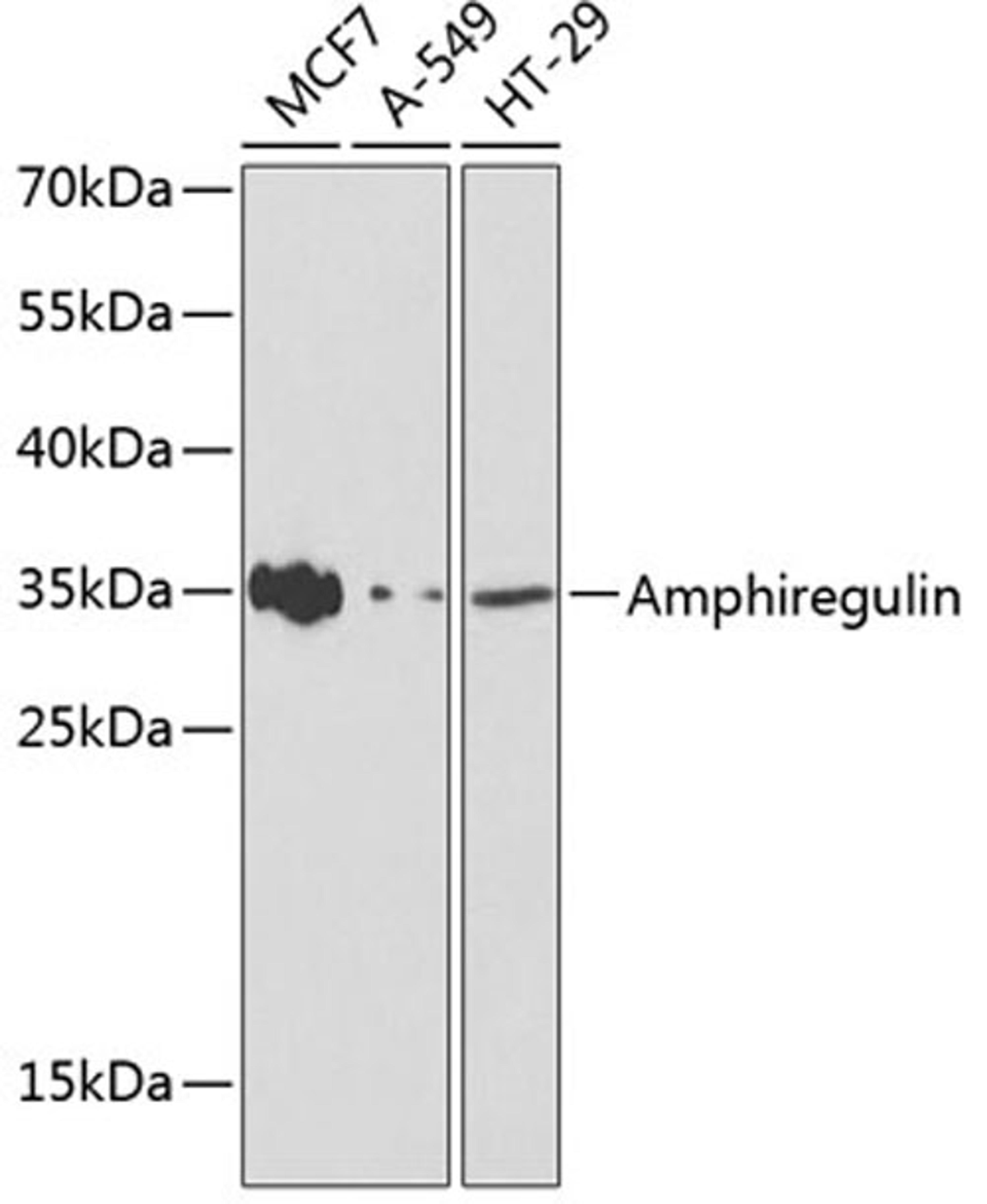 Western blot - Amphiregulin antibody (A1860)