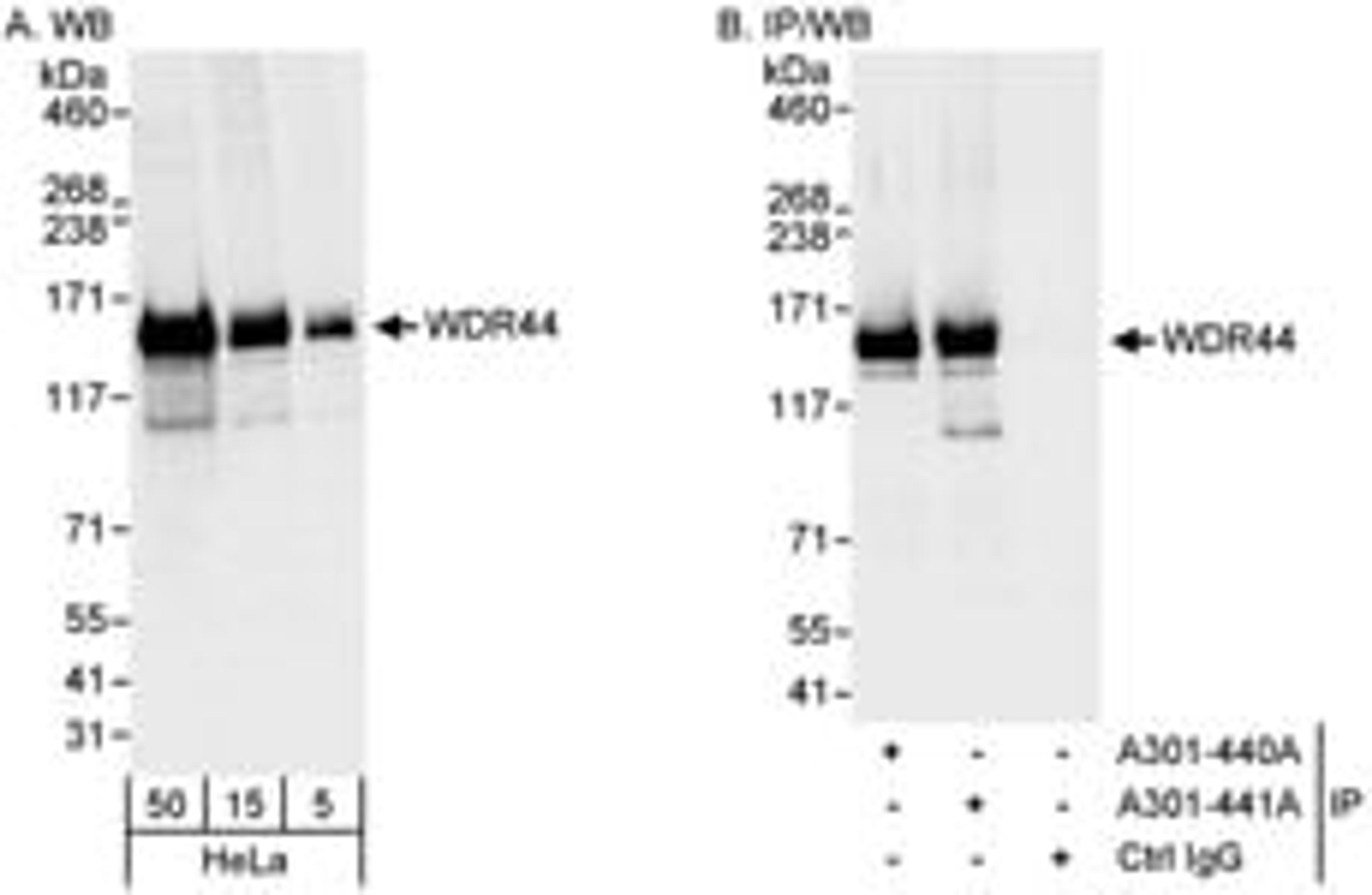 Detection of human WDR44 by western blot and immunoprecipitation.