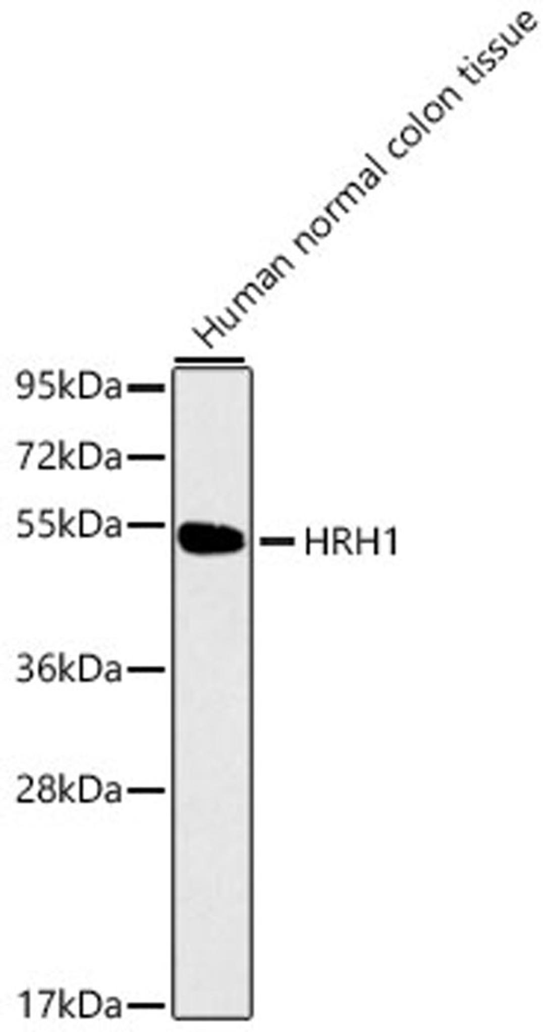 Western blot - HRH1 antibody (A1422)