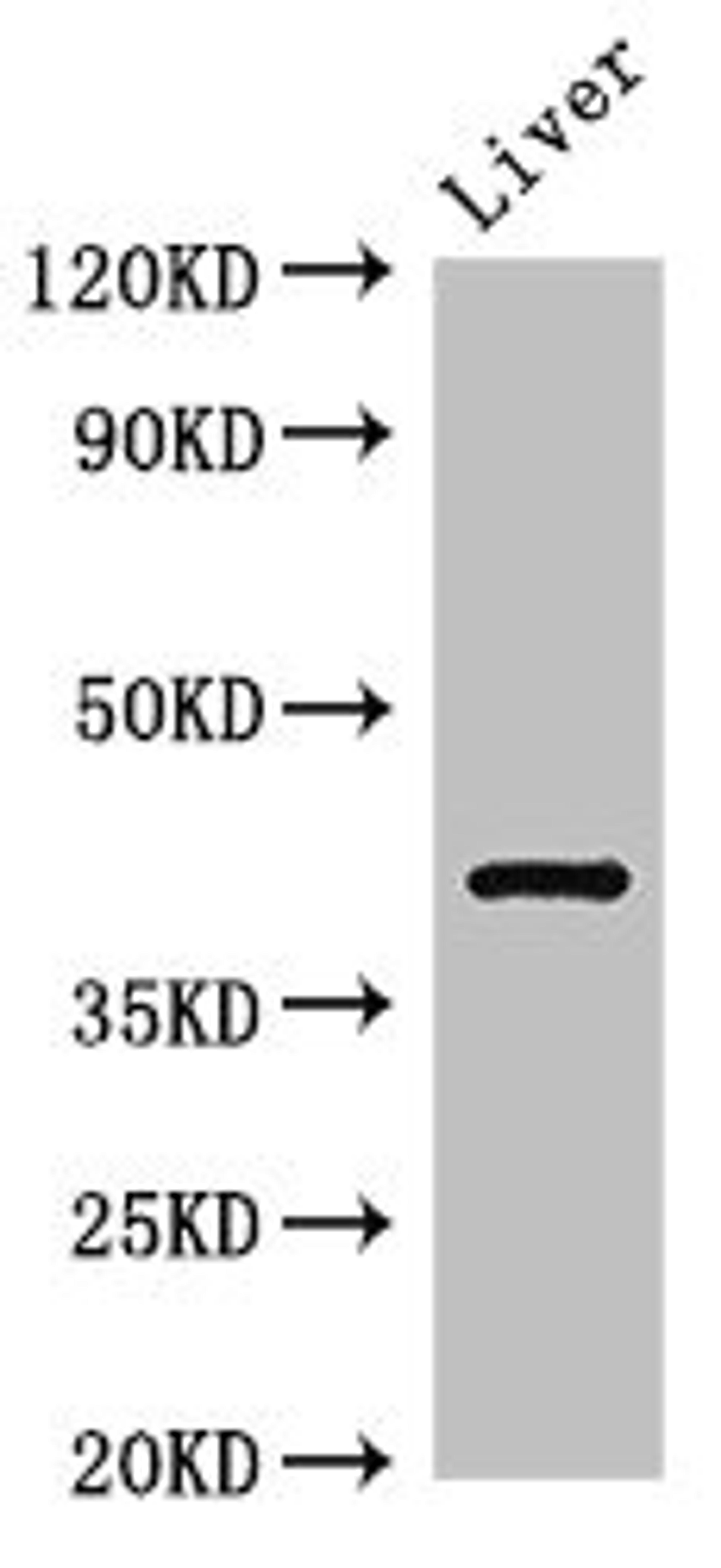 Western Blot. Positive WB detected in: Rat liver tissue. All lanes: TGDS antibody at 3ug/ml. Secondary. Goat polyclonal to rabbit IgG at 1/50000 dilution. Predicted band size: 41 kDa. Observed band size: 41 kDa. 