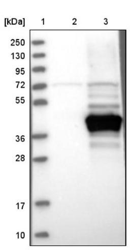 Western Blot: RTDR1 Antibody [NBP1-86045] - Lane 1: Marker [kDa] 250, 130, 95, 72, 55, 36, 28, 17, 10<br/>Lane 2: Negative control (vector only transfected HEK293T lysate)<br/>Lane 3: Over-expression lysate (Co-expressed with a C-terminal myc-DDK tag (~3.1 kDa) in mammalian HEK293T cells, LY415282)