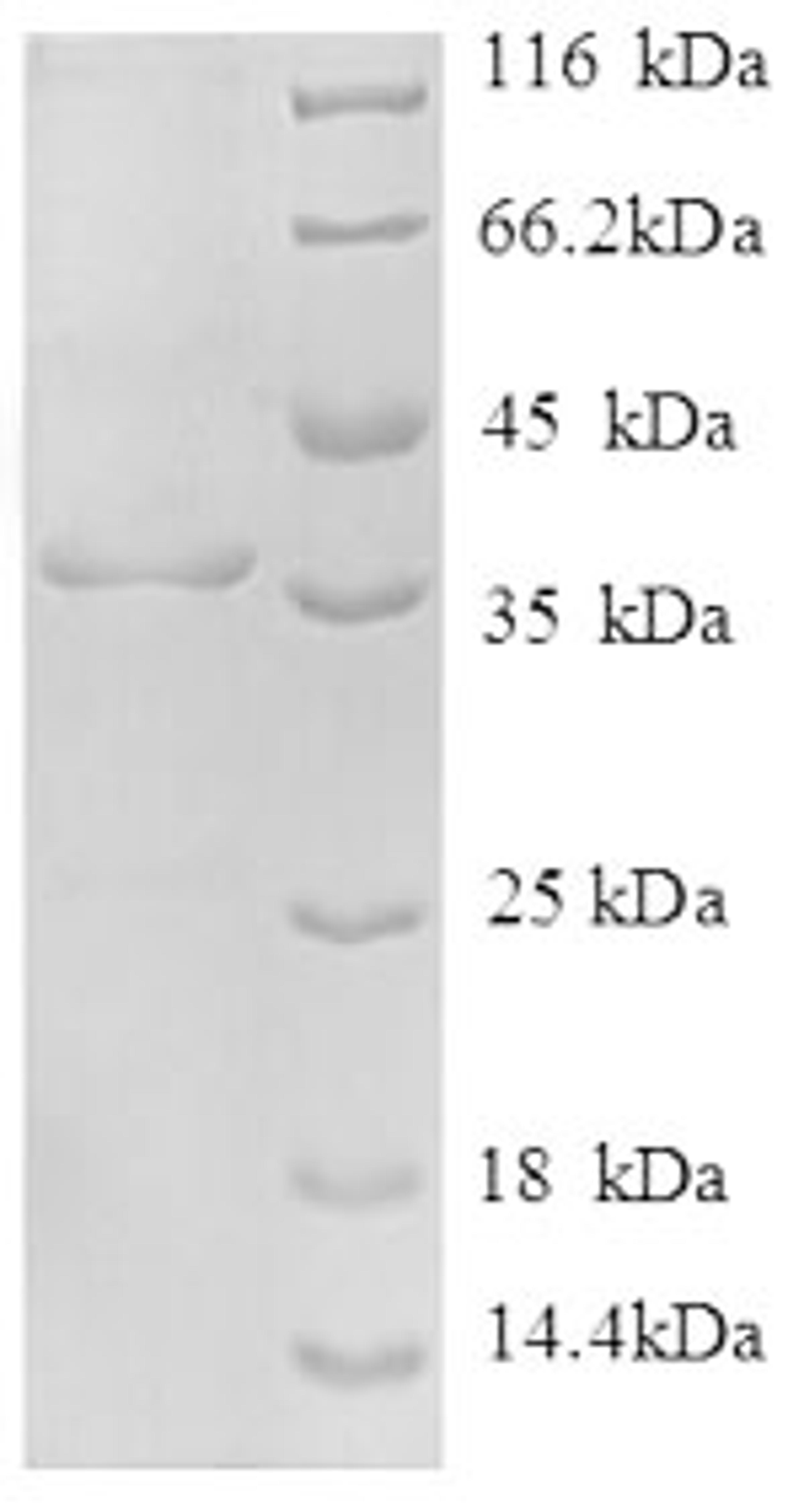 (Tris-Glycine gel) Discontinuous SDS-PAGE (reduced) with 5% enrichment gel and 15% separation gel.