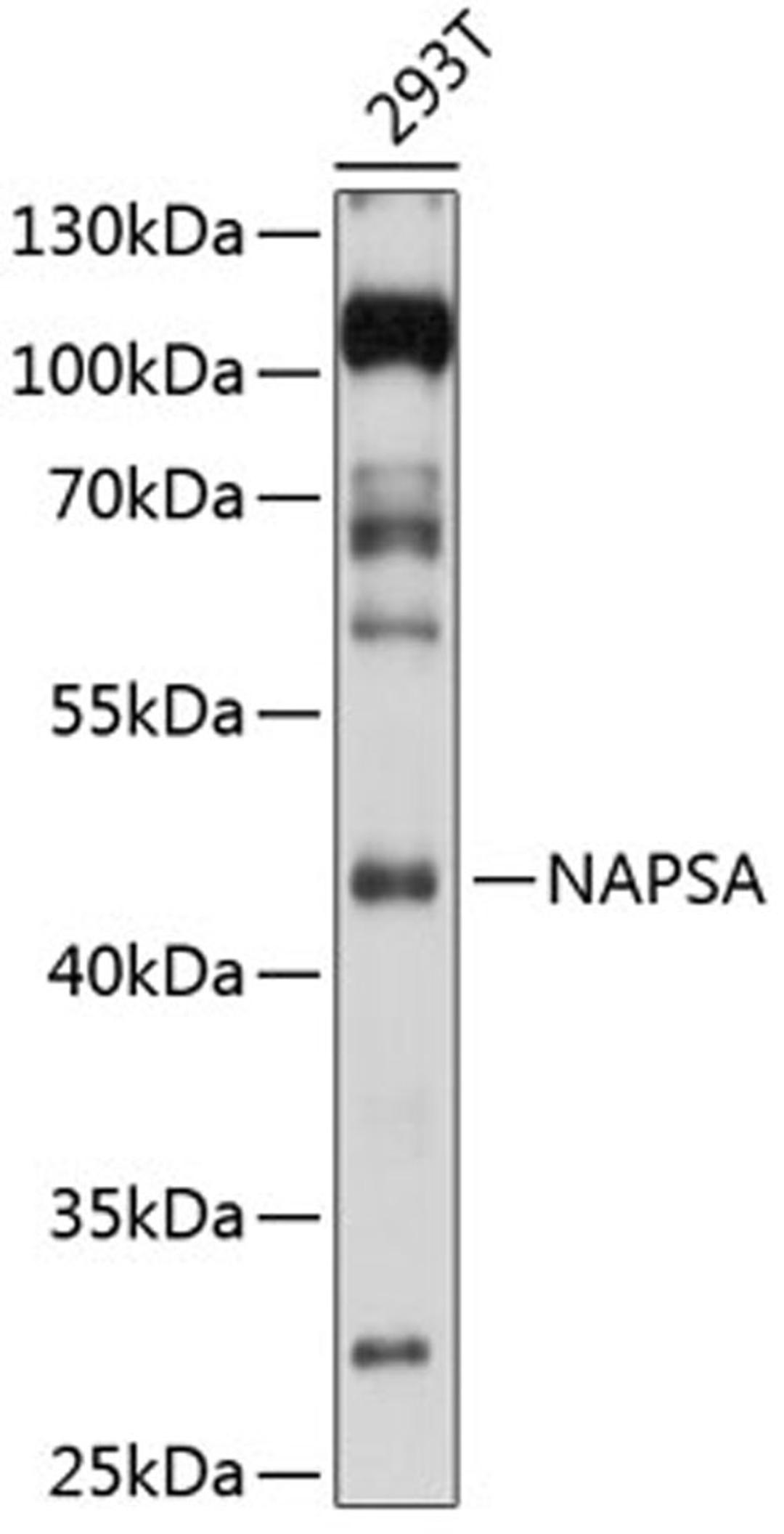 Western blot - NAPSA antibody (A5594)