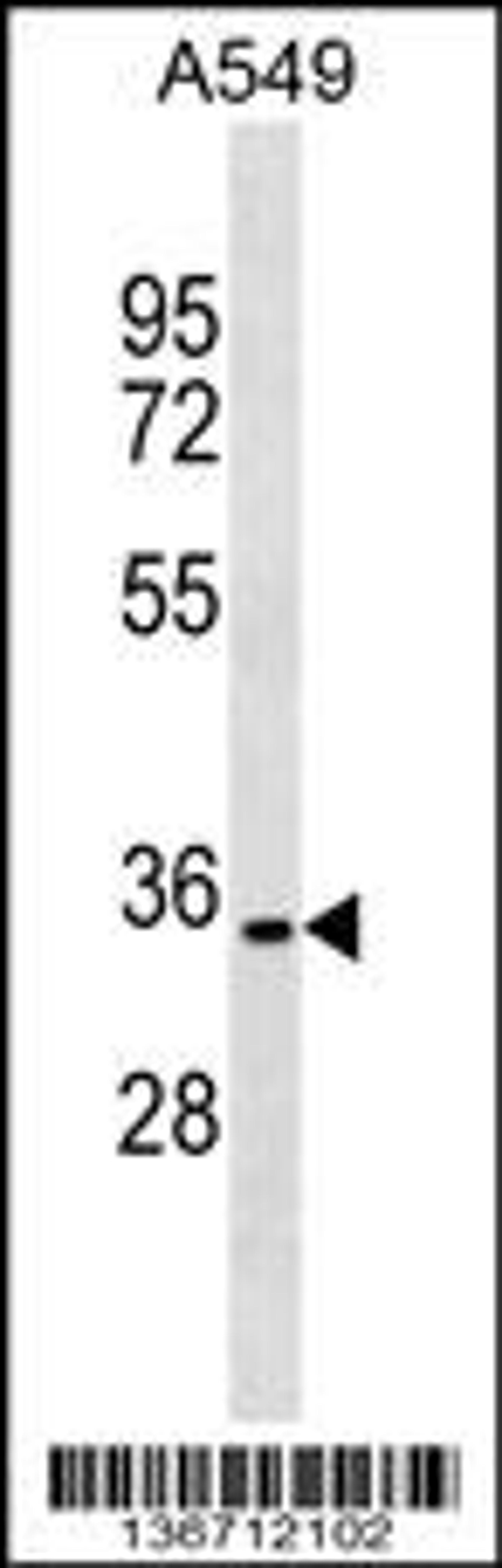 Western blot analysis in A549 cell line lysates (35ug/lane).