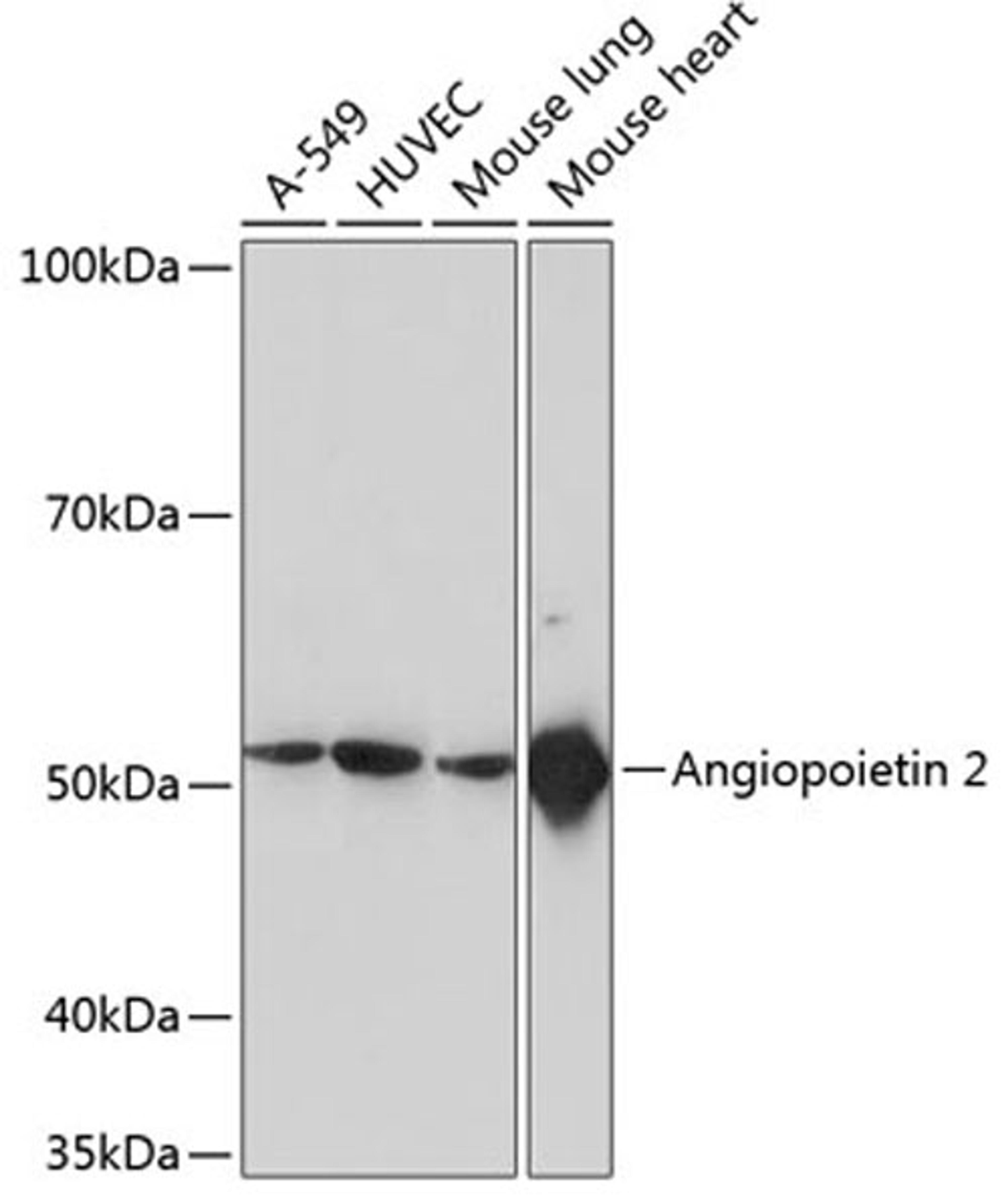 Western blot - ANGPT2 Rabbit mAb (A11306)