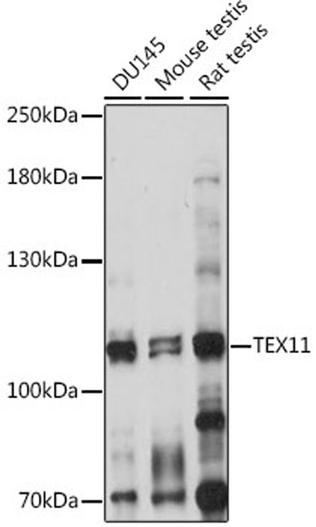 Western blot - TEX11 antibody (A15868)