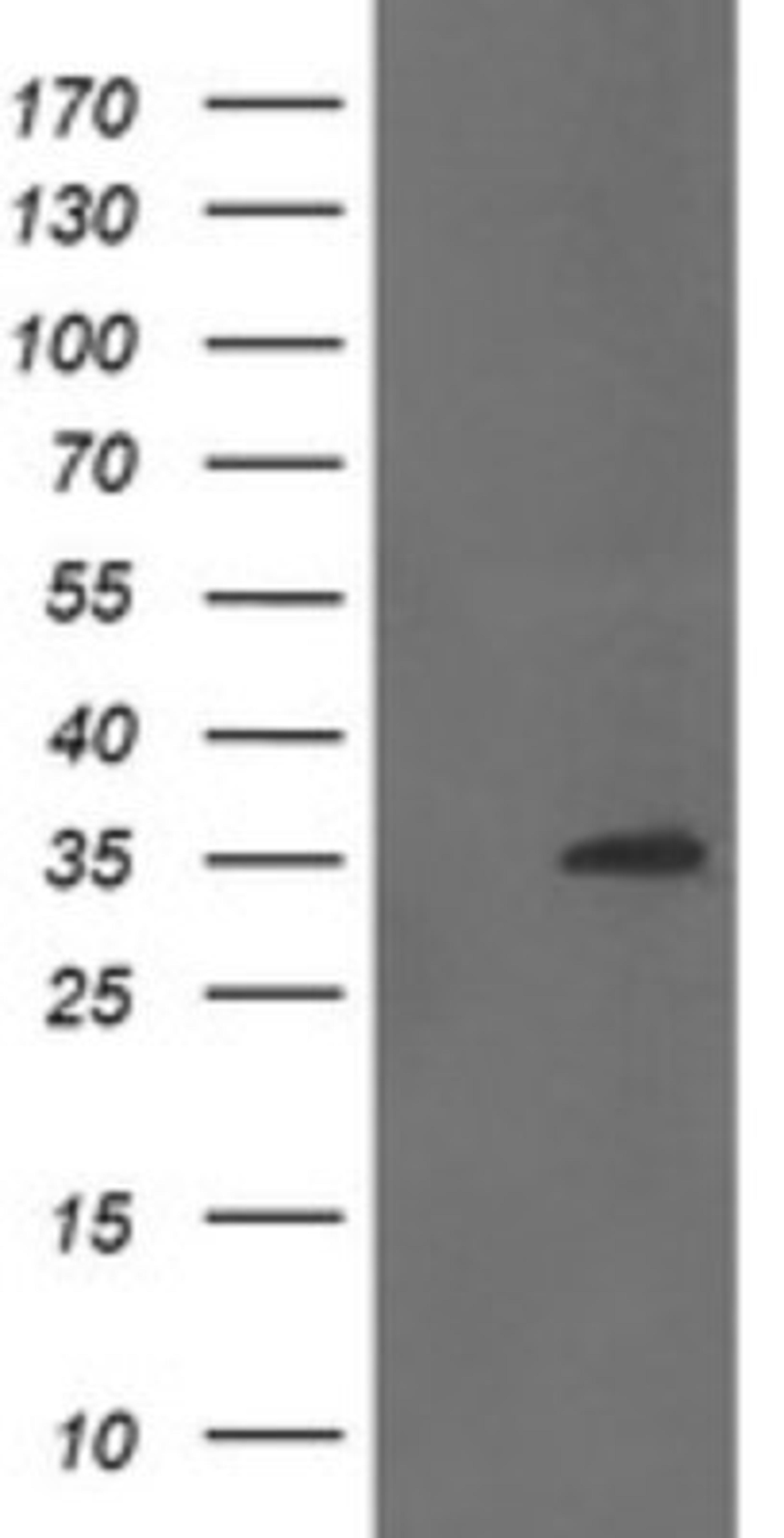 Western Blot: ZC2HC1B Antibody (4C1) [NBP2-45700] - Analysis of HEK293T cells were transfected with the pCMV6-ENTRY control (Left lane) or pCMV6-ENTRY ZC2HC1B.