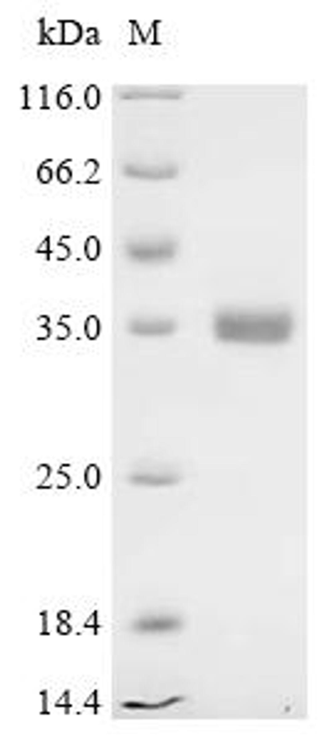 (Tris-Glycine gel) Discontinuous SDS-PAGE (reduced) with 5% enrichment gel and 15% separation gel.