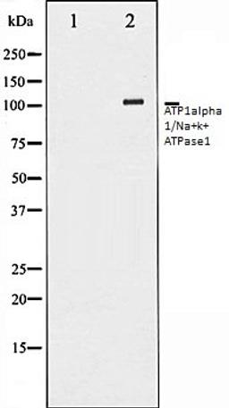 Western blot analysis of HeLa whole cell lysates using ATP1alpha1/Na+K+ ATPase1 antibody, The lane on the left is treated with the antigen-specific peptide.