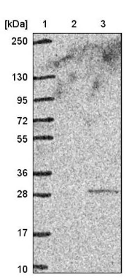 Western Blot: MYL5 Antibody [NBP1-86279] - Lane 1: Marker [kDa] 250, 130, 95, 72, 55, 36, 28, 17, 10<br/>Lane 2: Negative control (vector only transfected HEK293T lysate)<br/>Lane 3: Over-expression lysate (Co-expressed with a C-terminal myc-DDK tag (~3.1 kDa) in mammalian HEK293T cells, LY419312)