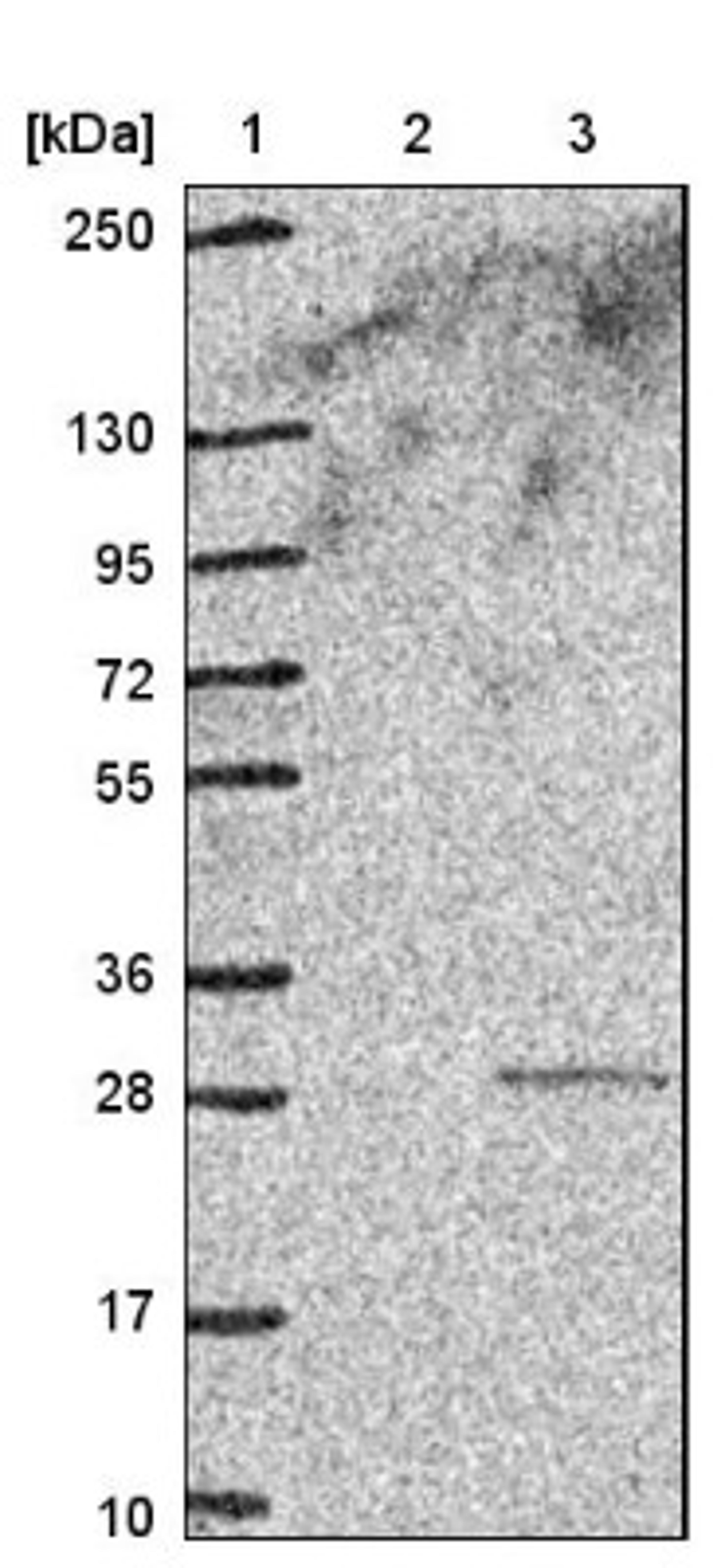 Western Blot: MYL5 Antibody [NBP1-86279] - Lane 1: Marker [kDa] 250, 130, 95, 72, 55, 36, 28, 17, 10<br/>Lane 2: Negative control (vector only transfected HEK293T lysate)<br/>Lane 3: Over-expression lysate (Co-expressed with a C-terminal myc-DDK tag (~3.1 kDa) in mammalian HEK293T cells, LY419312)