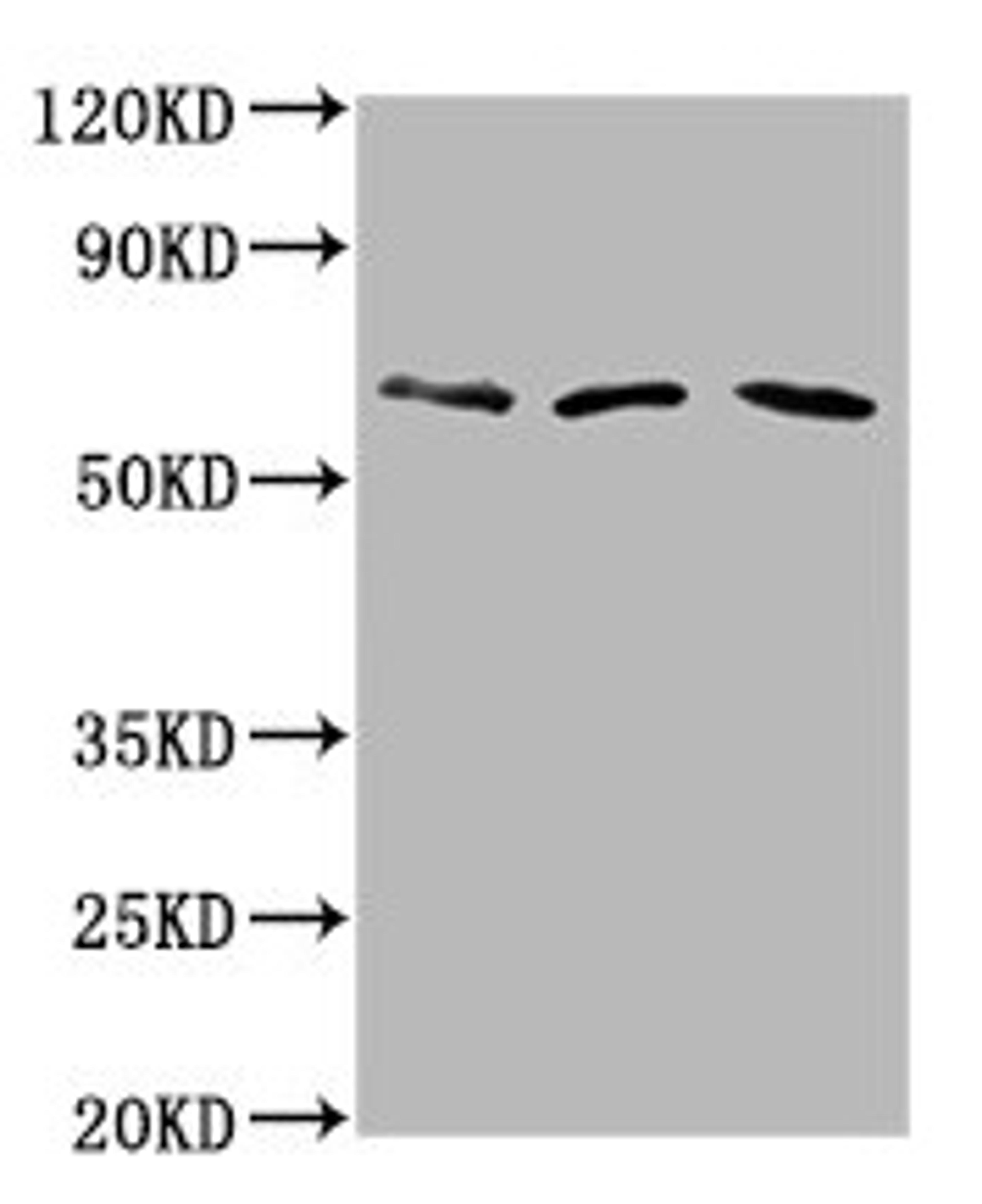 Western Blot. Positive WB detected in: Hela whole cell lysate, Rat brain tissue, Mouse brain tissue. All lanes: PHACTR1 antibody at 6µg/ml. Secondary. Goat polyclonal to rabbit IgG at 1/50000 dilution. Predicted band size: 67, 55 kDa. Observed band size: 67 kDa