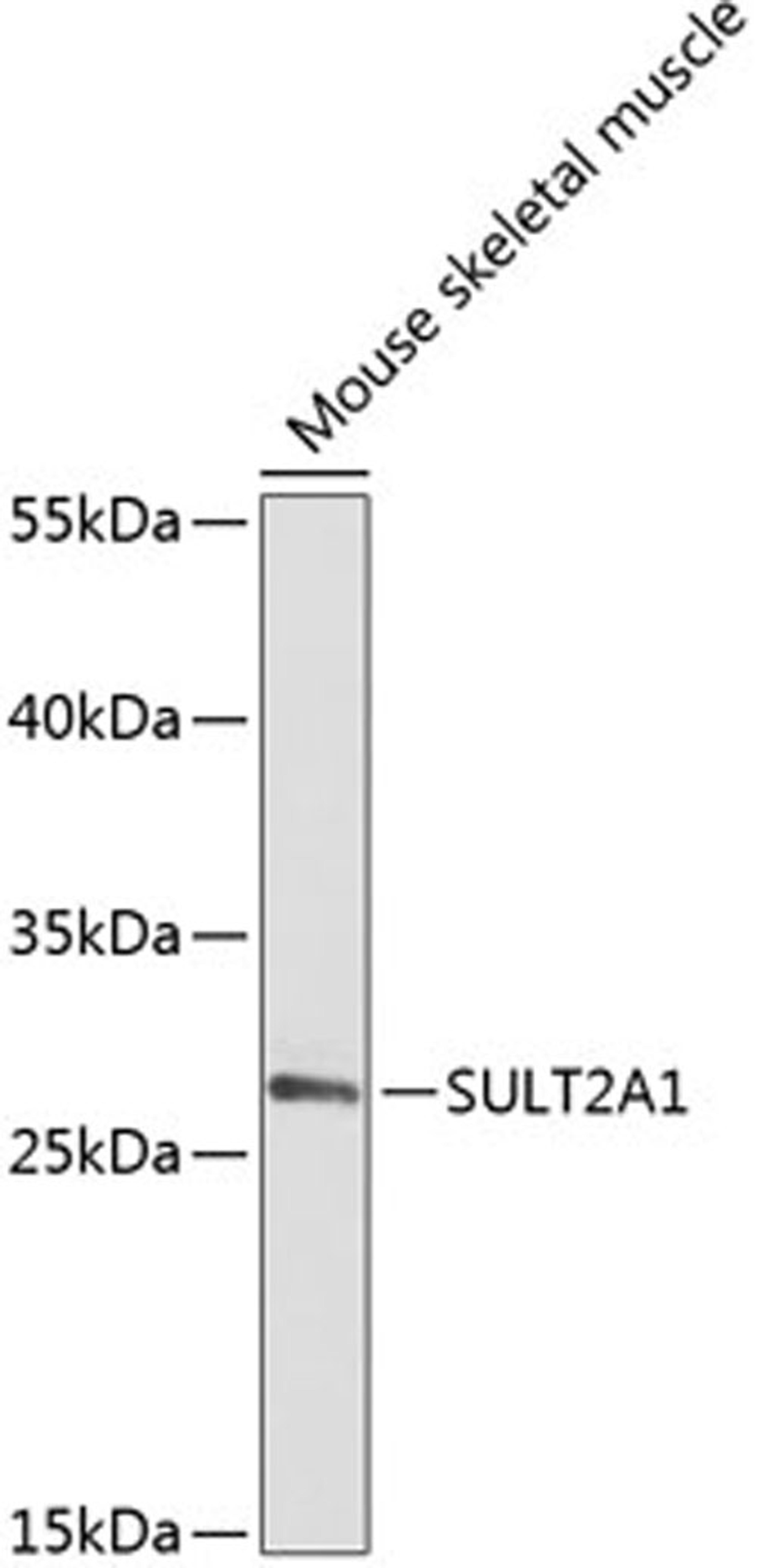 Western blot - SULT2A1 antibody (A14063)