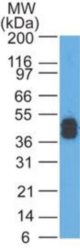 Western Blot: Cytokeratin, Acidic (Type I or LMW) Antibody (SPM115) [NBP2-34346] - Western blot analysis of A431 lysate using Cytokeratin, LMW Ab (SPM115).