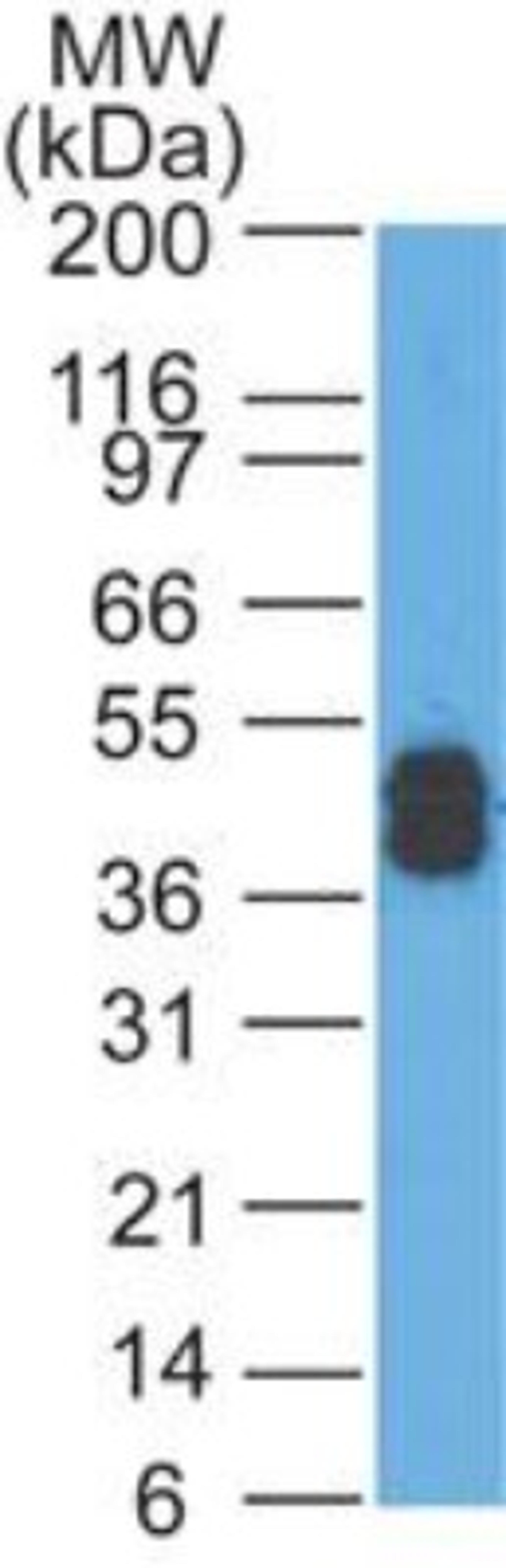 Western Blot: Cytokeratin, Acidic (Type I or LMW) Antibody (SPM115) [NBP2-34346] - Western blot analysis of A431 lysate using Cytokeratin, LMW Ab (SPM115).