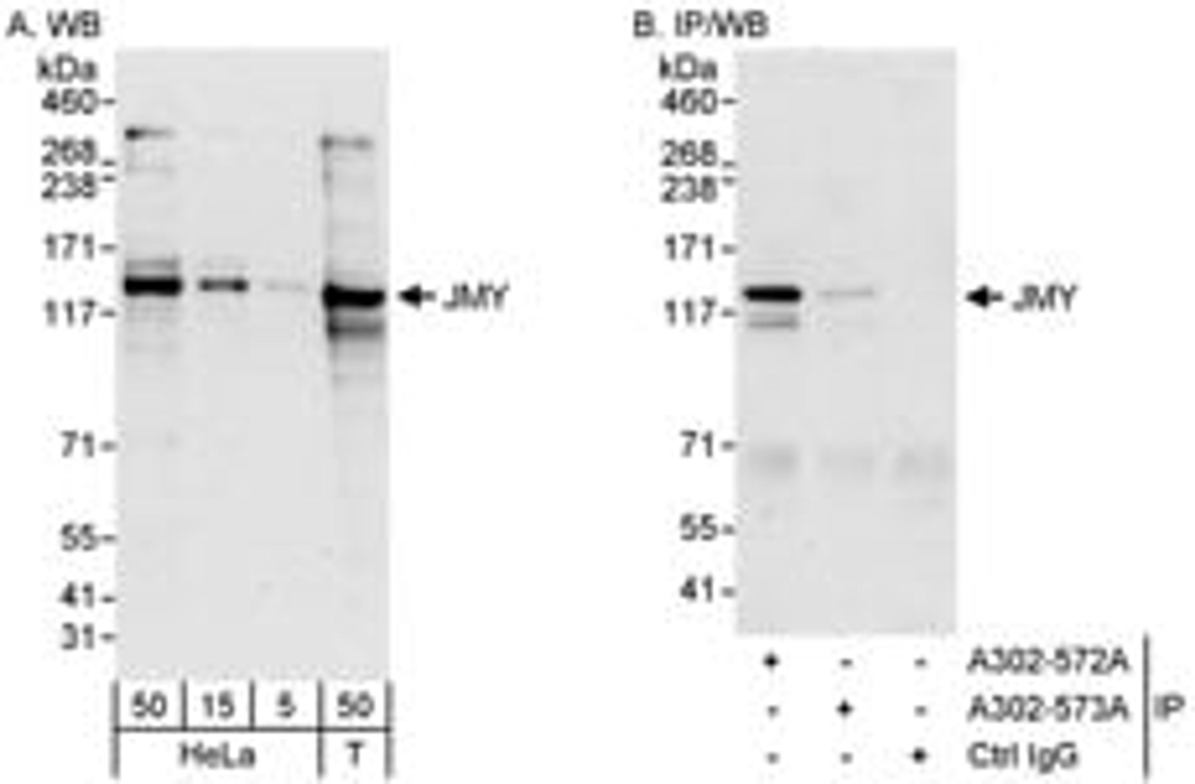 Detection of human JMY by western blot and immunoprecipitation.