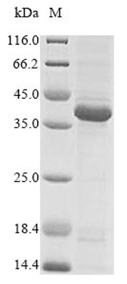 (Tris-Glycine gel) Discontinuous SDS-PAGE (reduced) with 5% enrichment gel and 15% separation gel.